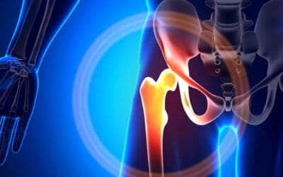 Anterior Approach Hip Replacement With Dr. Gupta